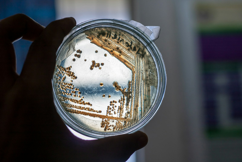 Bacterial colonies in a petri dish